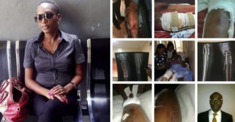 Ivie Edobor battered